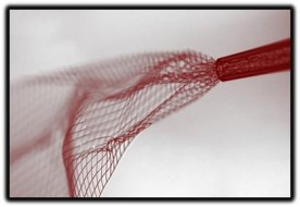 mesh netting